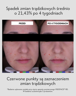 Maska oczyszczająco-regenerująca do cery trądzikowej z białą glinką Anti-Acne Orphica Clinic 100 ml - 5