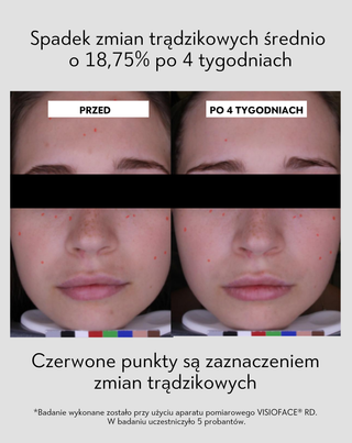 Peeling do twarzy do skóry trądzikowej z niacynamidem, pantenolem, BHA i mikrogranulkami Anti-Acne Orphica Clinic - 5