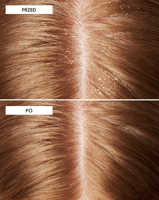 Szampon przeciwłupieżowy Nutridome _przed_po - 5