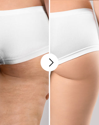 Tabletki na cellulit i poprawę kondycji skóry z naturalnymi ekstraktami Cellinea 60 kapsułek_3 - 3