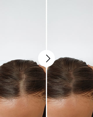 Kapsułki na wypadanie włosów  o działaniu zagęszczającym i wzmacniającym Follixin 60 kapsułek