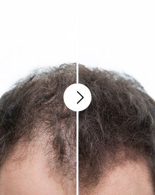 Kapsułki na wypadanie włosów o działaniu zagęszczającym i wzmacniającym Follixin 60 kapsułek_2 - 2