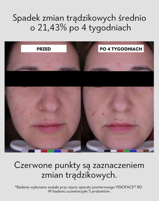Przeciwtrądzikowy krem na dzień z kwasem salicylowym i azelainowym na niedoskonałości Anti-Acne Orphica Clinic 50 ml - 5