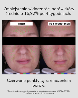Serum na noc wspierające regenerację cery trądzikowej Anti-Acne Orphica Clinic 50 ml - 6