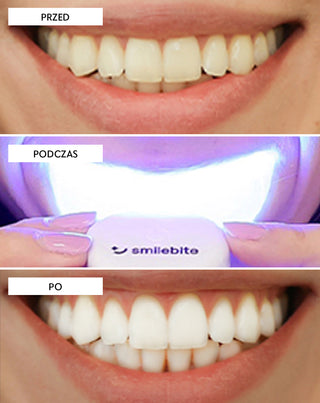 Zestaw do wybielania zębów z lampą LED i żelem wybielającym Light & Bright Smilebite