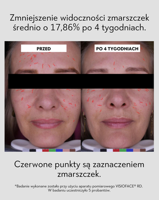 Przeciwtrądzikowy krem na dzień z kwasem salicylowym i azelainowym na niedoskonałości Anti-Acne Orphica Clinic 50 ml - 6