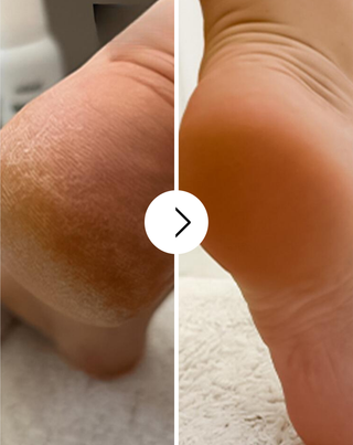 Zmiękczający krem do stóp z mocznikiem i masłem shea Nutridome - 4