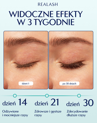 Odżywka do rzęs Realash wydłużająca, wzmacniająca i zagęszczająca rzęsy Orphica Clinic - 4