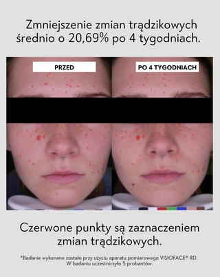 Serum na noc wspierające regenerację cery trądzikowej Anti-Acne Orphica Clinic 50 ml