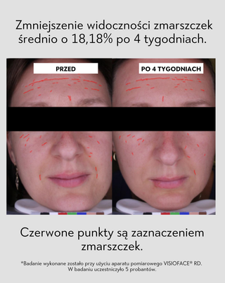 Serum na noc wspierające regenerację cery trądzikowej Anti-Acne Orphica Clinic 50 ml