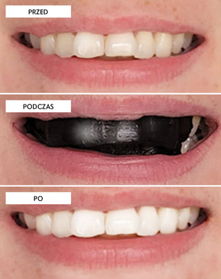 Paski wybielające zęby The White(ning) Stripes Smilebite zestaw 28 szt.