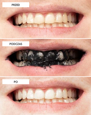 Proszek do wybielania zębów z węglem kokosowym Smilebite