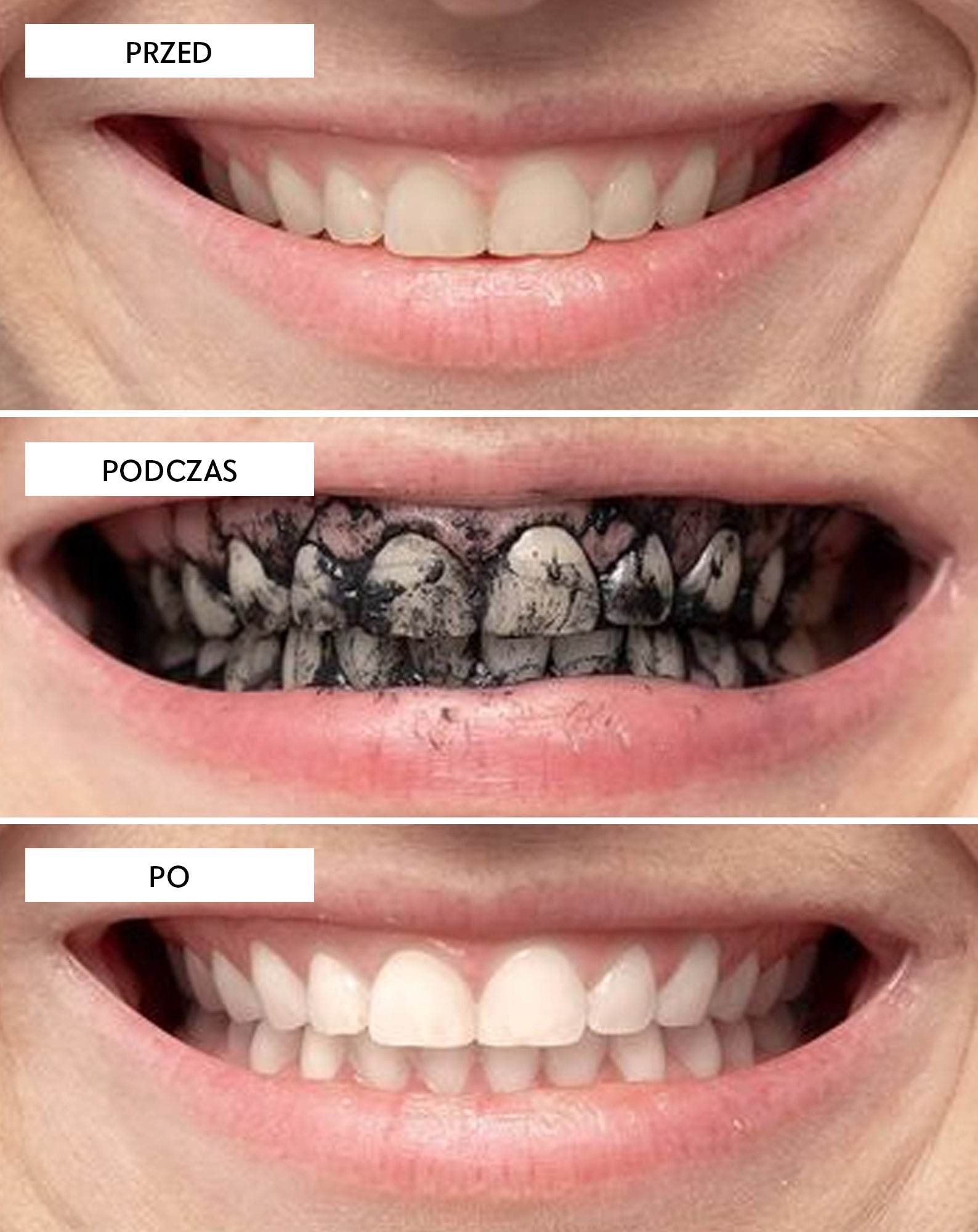 Proszek do wybielania zębów z węglem kokosowym Smilebite - 6