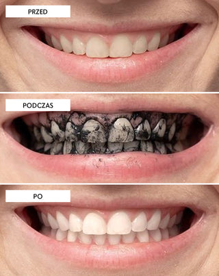 Proszek do wybielania zębów z węglem kokosowym Smilebite