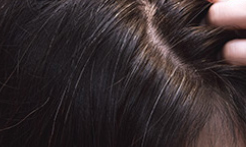Użytkownicy - Serum do włosów i skóry głowy dla kobiet Fortesse Halier