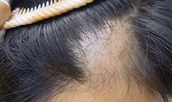 Użytkownicy - Serum do włosów i skóry głowy dla mężczyzn Fortive Halier