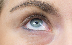 Użytkownicy - Skoncentrowane serum pod oczy na cienie, na zmarszczki, na opuchnięcia Pure Orphica